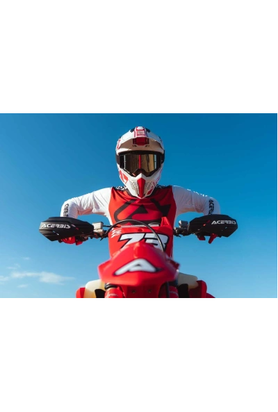 Acerbis hand guards: a complete guide to open and closed systems 2026